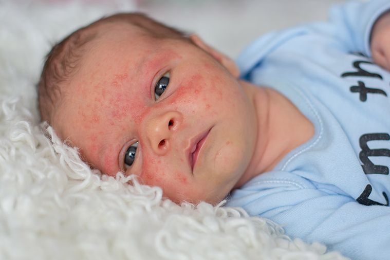 Bella Dermatology McDonough Services