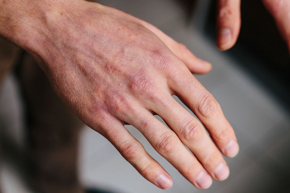 Bella Dermatology McDonough Services