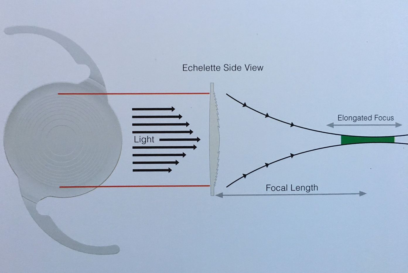 Private Cataract Surgeon Taunton Mr Jonathan D Rossiter FRCOphth