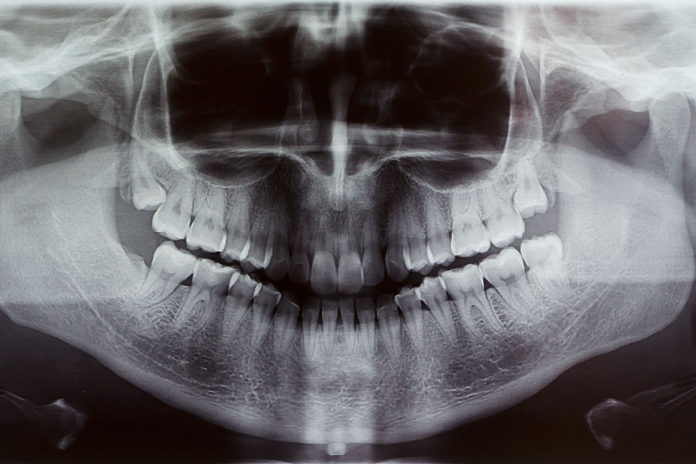 Washington Endodontics Advanced Dental Technology