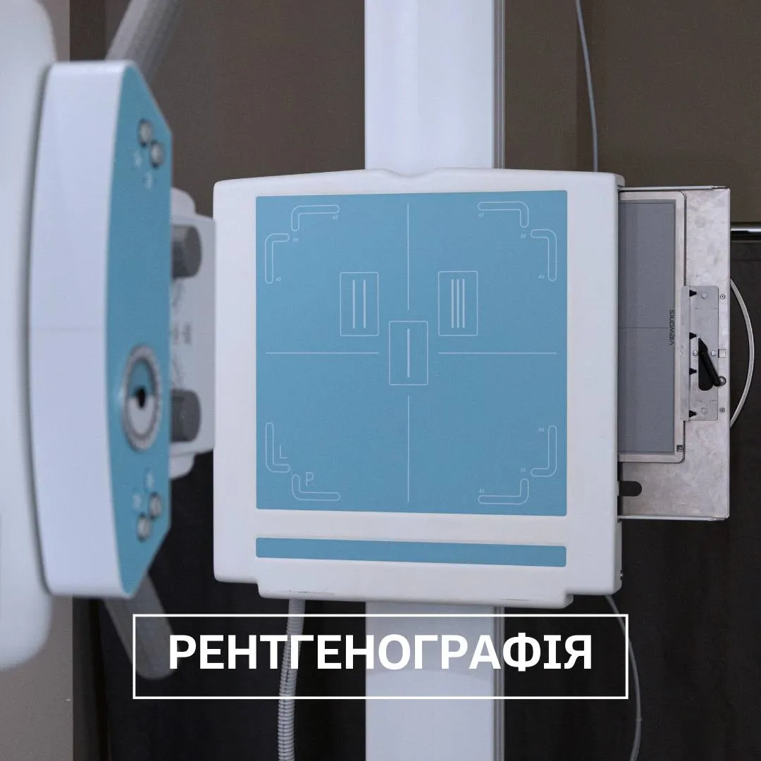 Цифрова рентгенографія в Кредоклінік