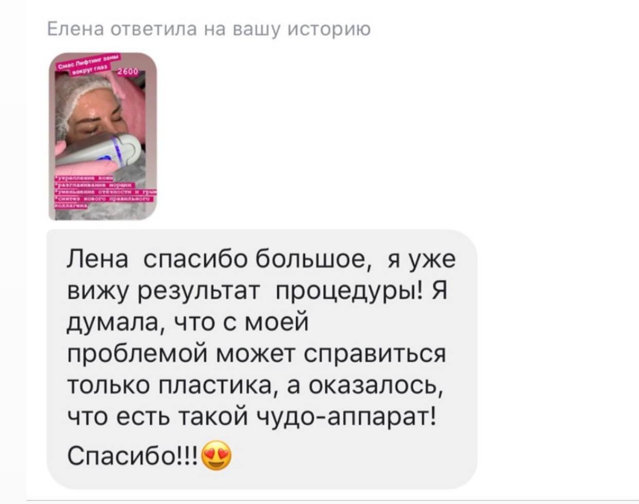 Відгук клієнтки Smart Beauty Clinic про SMAS-ліфтинг, фото 4