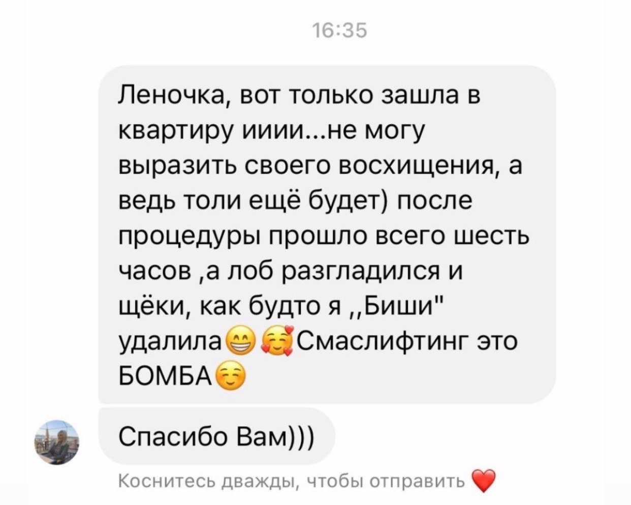 Відгук клієнтки Smart Beauty Clinic про SMAS-ліфтинг, фото 1