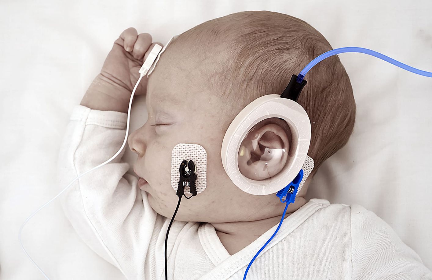 діаностика слуху дитині