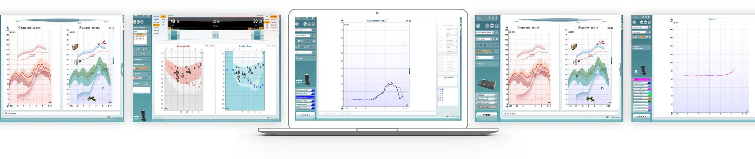 програмні модулі для виконання аудіометрії